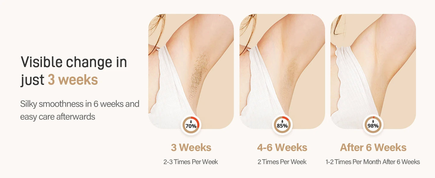 SilkSkin Pro IPL Laser Hair Removal Device